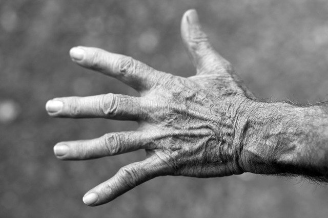 hand-351277_640 Cosa sono le ragadi alle mani